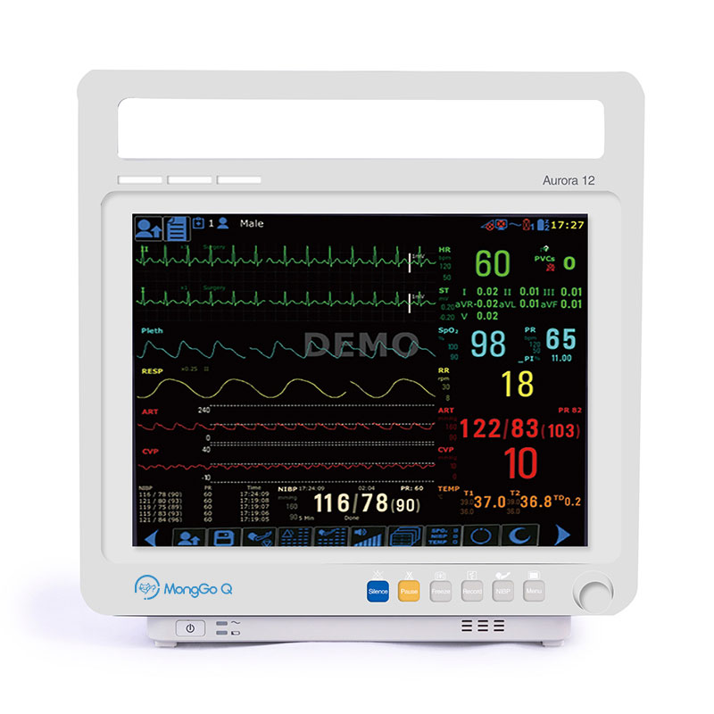 veterinary patient monitor 12.1-inch big screen portable patient monitor for cats and dogs